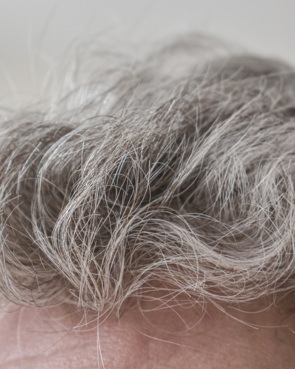 Cuir chevelu homme âgé aux cheveux blancs.