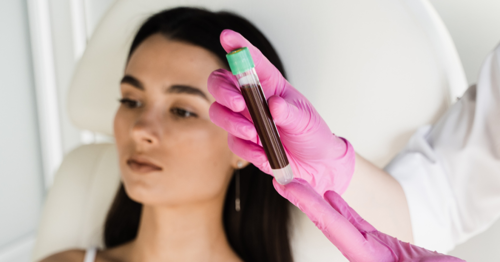 Processus de prise de sang pour le vampire lift
